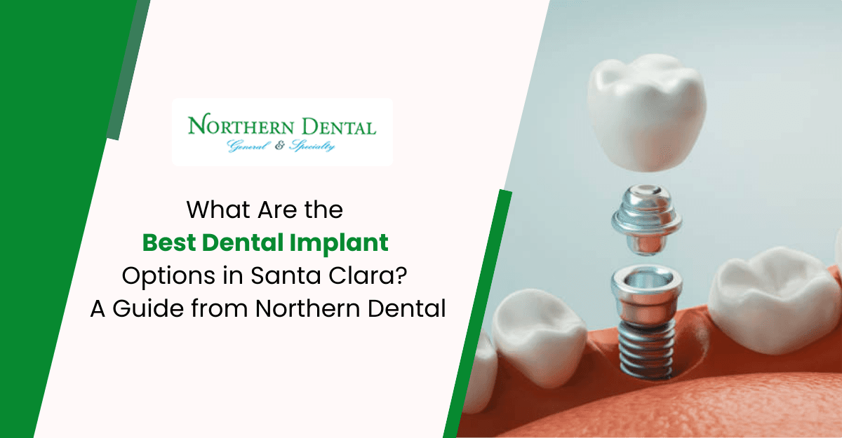 What Are the Best Dental Implant Options in Santa Clara? A Guide from Northern Dental