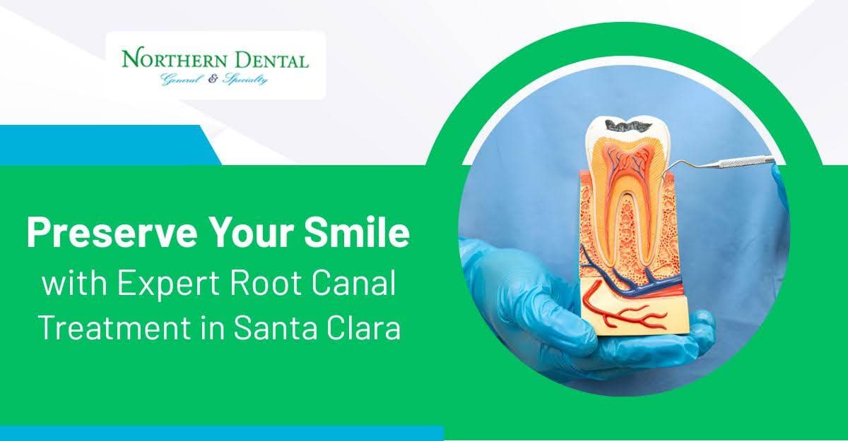 Preserve Your Smile with Expert Root Canal Treatment in Santa Clara