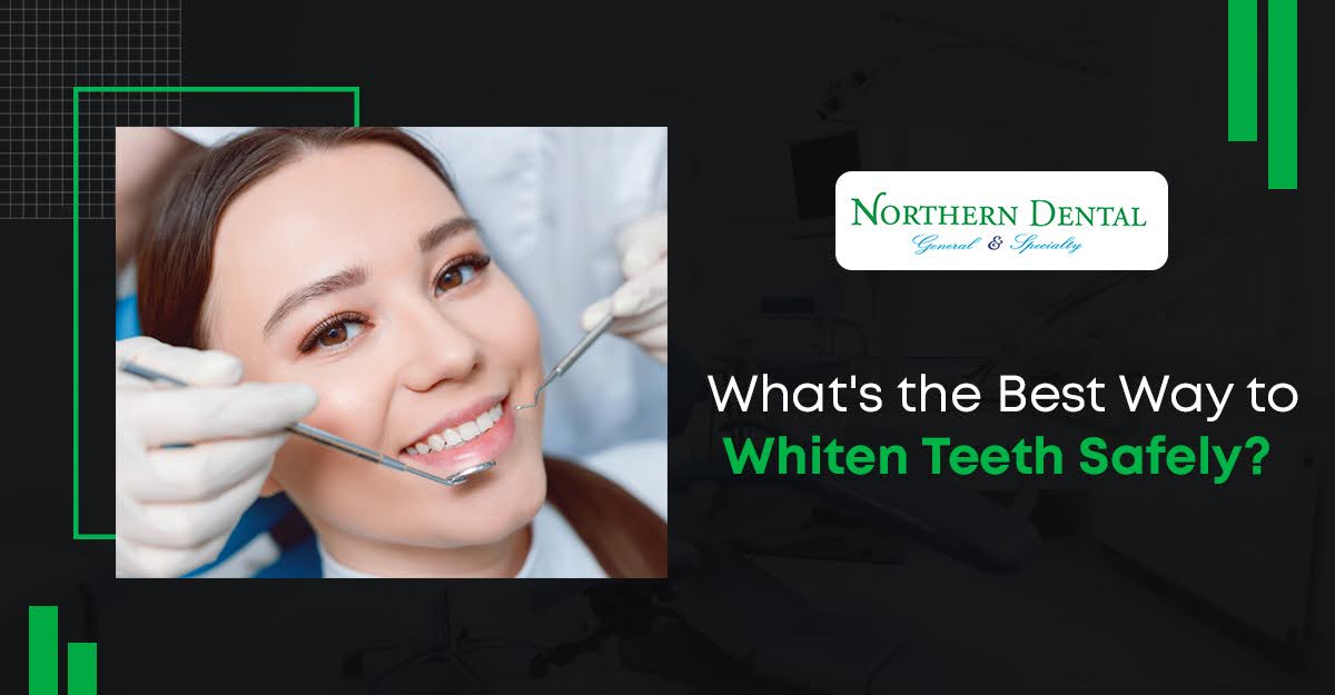 safe teeth whitening options santa clara